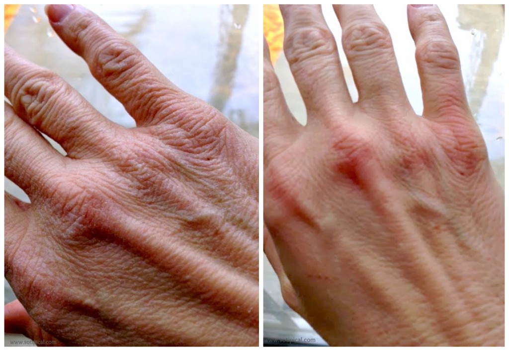 hands-before-after